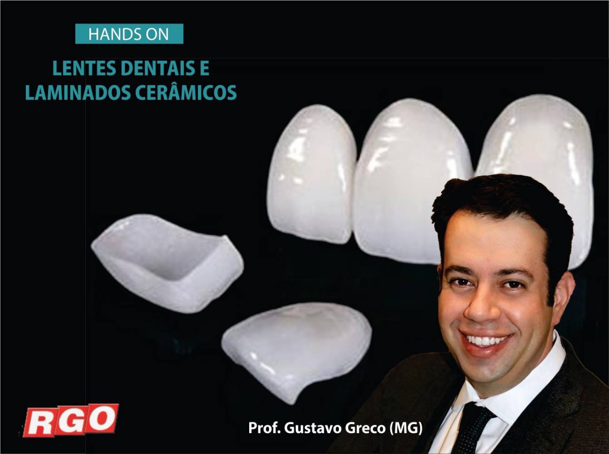 Curso Online de Lentes Dentais e Laminados Cerâmicos RGO Odontologia